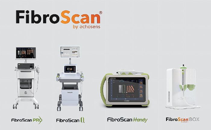 ݼ໼ߣFibroScan ιܼвؼĿҽ