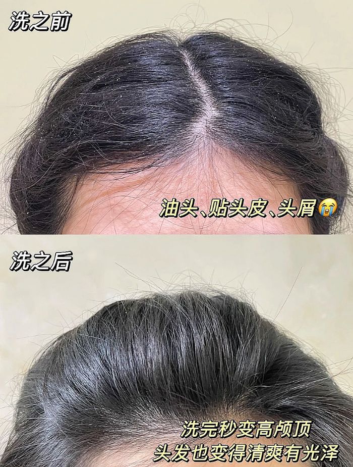 ȫ�����õ�ȥм����ϴ��ˮѡ�ĸ���2026ȫ����οڱ�֮��������С��ͷ�����Ͷ����Ŀ�����ģ�