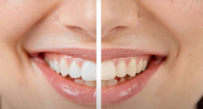 口臭、牙迹很显眼?2026这款牙膏,牙白芬芳持效18小时