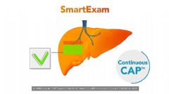 FibroScanά˲ʱԲⶨӭܻ£Smart<font color='#FF0000'>e</font>xamϵͳƽٴάʹ