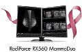 艺卓推出500万像素彩色医疗显示器RadiForce RX560