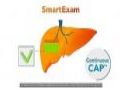 FibroScan肝纤维化瞬时弹性测定仪迎智能化革新:SmartExam系统破解临床运维三大痛点