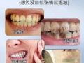 �������������ĸ����ã��ɷֵ�ʵ��Աȣ������������࣬ƽ�����ྐྵ�д��Ƽ��䷽